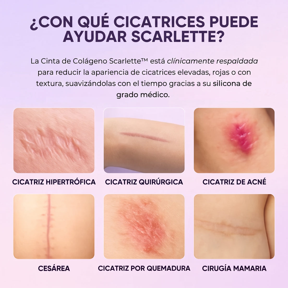 Scarlette: Láminas de Silicona con Colágeno