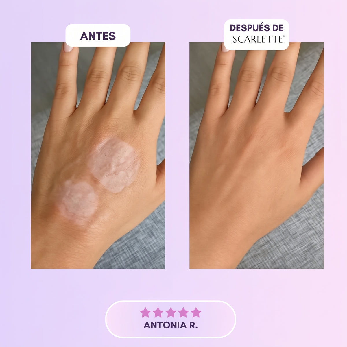 Scarlette: Láminas de Silicona con Colágeno