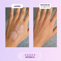 Scarlette: Láminas de Silicona con Colágeno