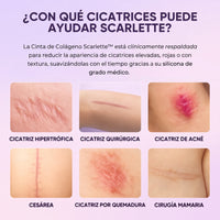 Scarlette: Láminas de Silicona con Colágeno